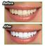 Miracle Teeth Whitener image