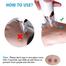 Multifunctional Cleaning Blackhead Remover - Black Head Remover image