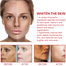 Ouhoe Dark Spot Cream 30 ml image