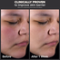 Paula’s Choice Skin Perfecting 2 Percent Bha Liquid Exfoliant 118ml image
