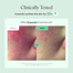 Purito Wonder Releaf Centella Cream Unscented 15 ml image