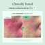 Purito Wonder Releaf Centella Serum Unscented 15ml image