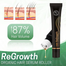 Regrowth Lengthening Hair Serum Strengthen Hair Loss, Hair Dry, Damaged Treatment Serum image