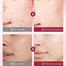 Sadoer Azelaic Acid Luxurious Essence Moisturizing Shrink Pores Refreshing Skin Beauty Essence-30ml image