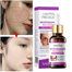 Sadoer Niacinamide Whitening Freckling Serum-30ml image