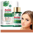 Sadoer Tea Tree Oil Control Anti-Acne Serum Essence -30ml image