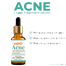 Skin'O Acne plus Spot Treatment Serum 30 ml image