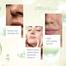 Skin Cafe Aloe Vera Facewash With Salicylic Acid - 140ml image