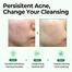 Some By Mi Aha Bha Pha 30 Days Miracle Cleansing Bar image