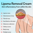 South Moon Lipoma Removal Cream-20g image