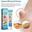 South Moon Lipoma Removal Cream – Fat Lump Dissolving Ointment for Skin Swelling and Body Care (20g) image
