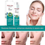 South Moon Medical Grade Scar Spray 20g image
