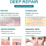 South Moon Medical Grade Scar Spray 20g image