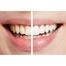 Spin Smile 360 Electric Tooth Polishing Cleaner Led Light Ultrasonic image