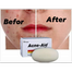 Stiefel Acne-Aid Bar Pimple Prone And Oily Skin Acne Aid Soap 100 gm image