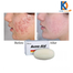 Stiefel Acne-Aid Bar Pimple Prone And Oily Skin Acne Aid Soap 100 gm image