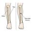 Tibia brace Tibial Support For Leg, Calf and Fibula Fracture Orthosis External Fixation image