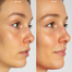 Vitamin C Skin Whitening V-C Injection image