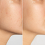 Vitamin C Skin Whitening V-C Injection image