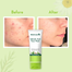 Wishcare 2 Percent Salicylic Acid Face Wash with AHA, GreenTea, Chamomile and Tea Tree for Oil and Acne Control - 100 ml image