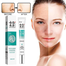 Yunnan Materia Medica Acne Pits and Scars, Closed Mouth Acne, Black Head, and Youth Acne Blemish Removal Cream - 20g image