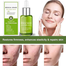  Eelhoe Scar Repair Serum Anti Acne Repair Serum Facial Tea Tree Oil Acne Pimple Scar Remover Essence Whitening Skin Care Beauty Advanced Scar Repair Serum 30ml image