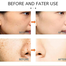  Japanese Melasma Cream, Hoshi Cream Japan, Dr Hancy White Spot Freckle Face Cream, Anti Ageing Face Moisturizing Skin Care Cream For All Type Skin - 1Pcs image